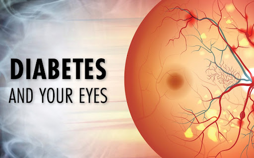 Improving Vision with Diabetic Eye Disease Treatment